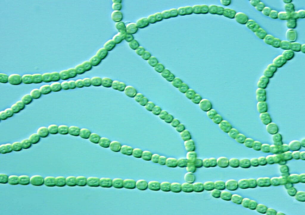 cyanobacteria under microscope